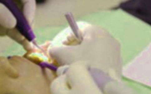 第一次拔牙六年級(jí)作文