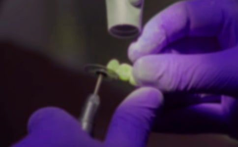 拔牙記四年級優(yōu)秀作文